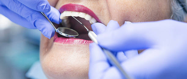 Best Emergency Treatment for Oral Infections in Boynton Beach, FL